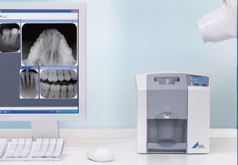 State-of-the-art digital dentistry equipment at our modern clinic in Aundh, Pune.