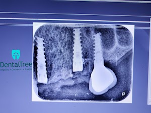 DentalTree Dental Clinic - Best Dentist in Pune | Dental Implant | Smile Designing | Root Canal Treatment place picture