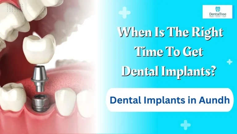 Dental Implants in Aundh