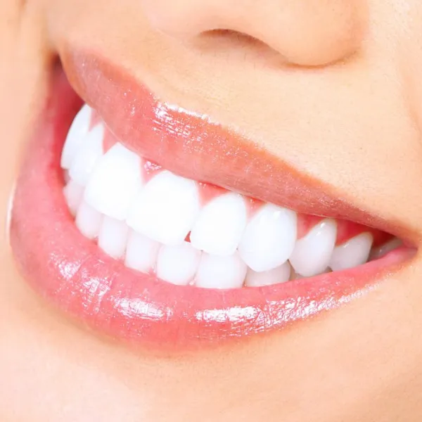 Teeth Whitening in Pune