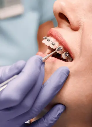 Orthodontist in Pune