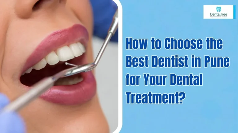 Best Dentist in Pune