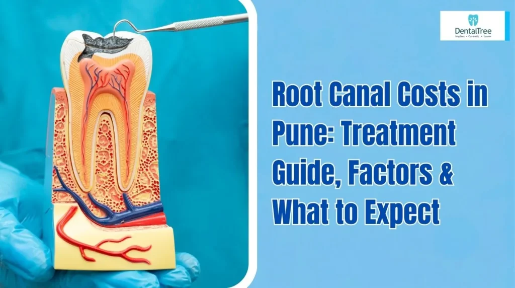 Root Canal Cost in Pune